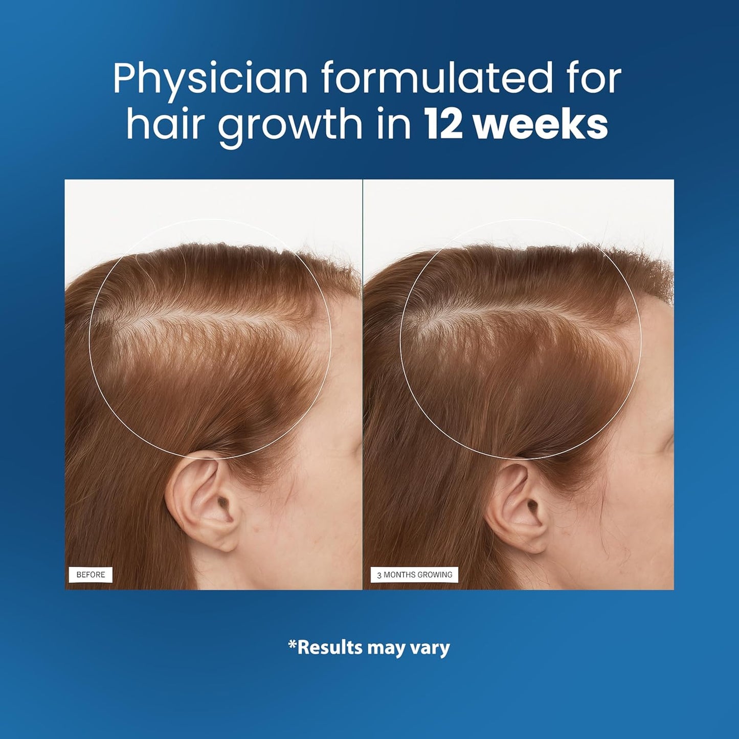 Lentura™ Hair Growth Roller