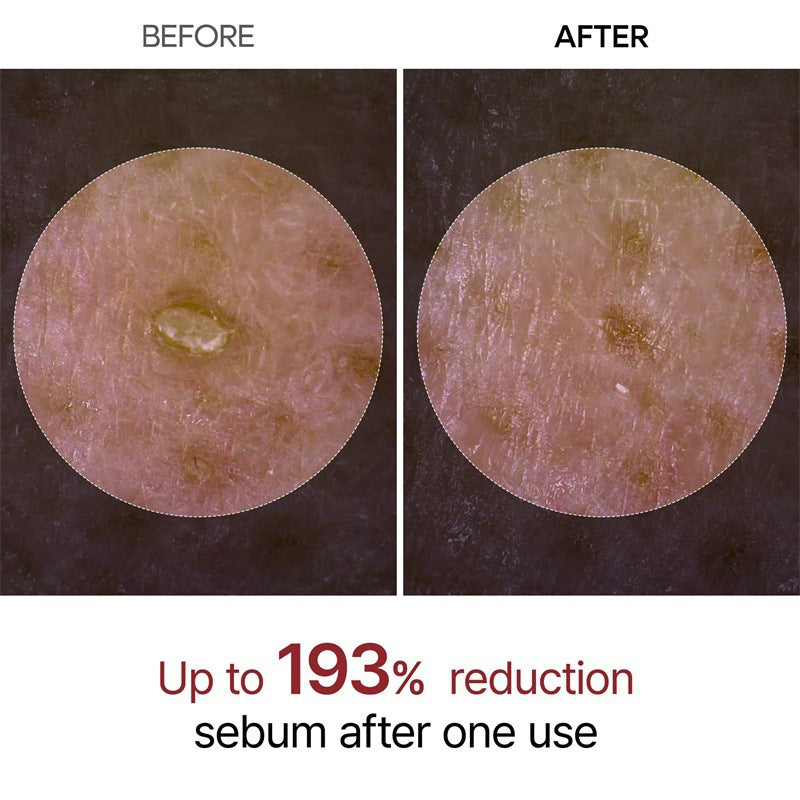 Lentura™ Peel Shot Glow