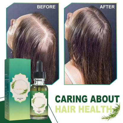 Lentura™ Hair Growth Oil