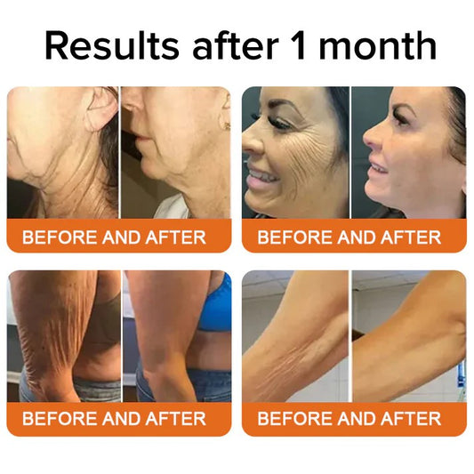 Lentura™ Skin Firming Cream